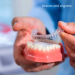 Braces And Aligners