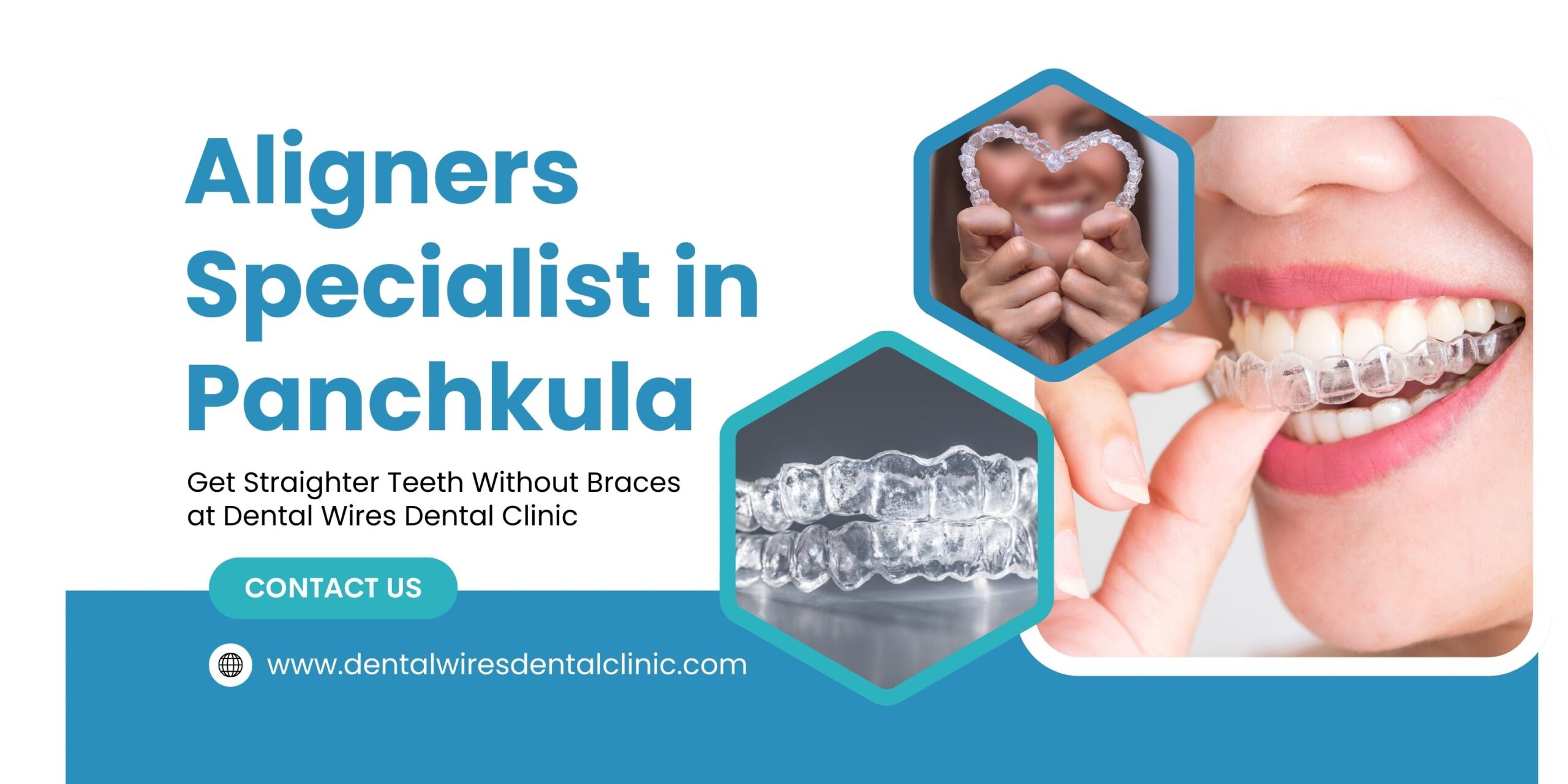Aligners Specialist in Panchkula