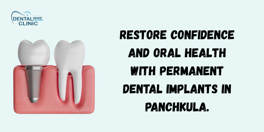Dental Implants in Panchkula