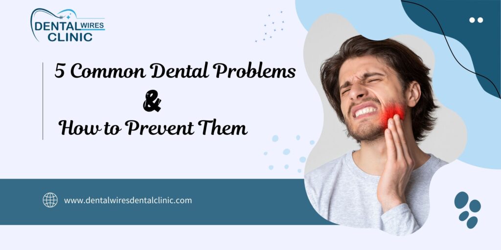 Common Dental Problems