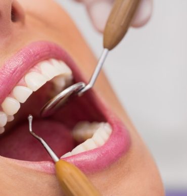 dentist-examining-female-patient-teeth_107420-65309